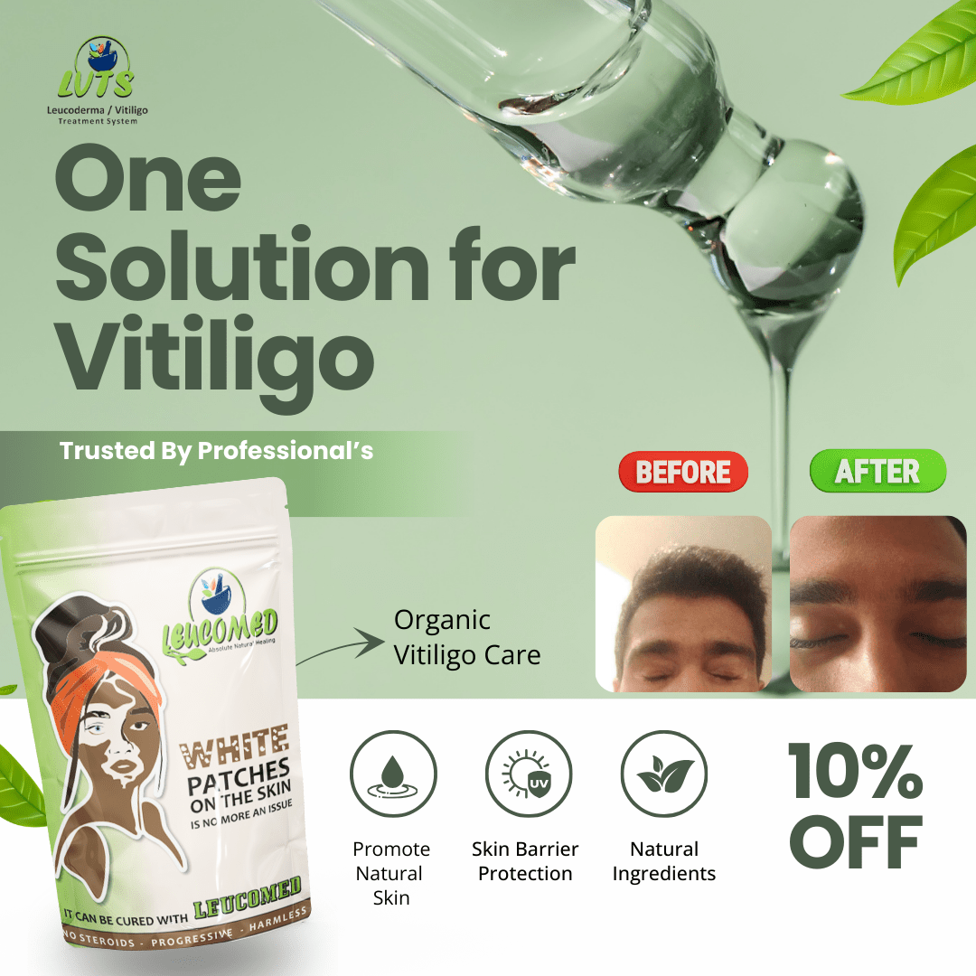 Leucomed - Absolute Natural Healing (60 Days Oral Dosage) - LVTS Leucoderma/Vitiligo Treatment System