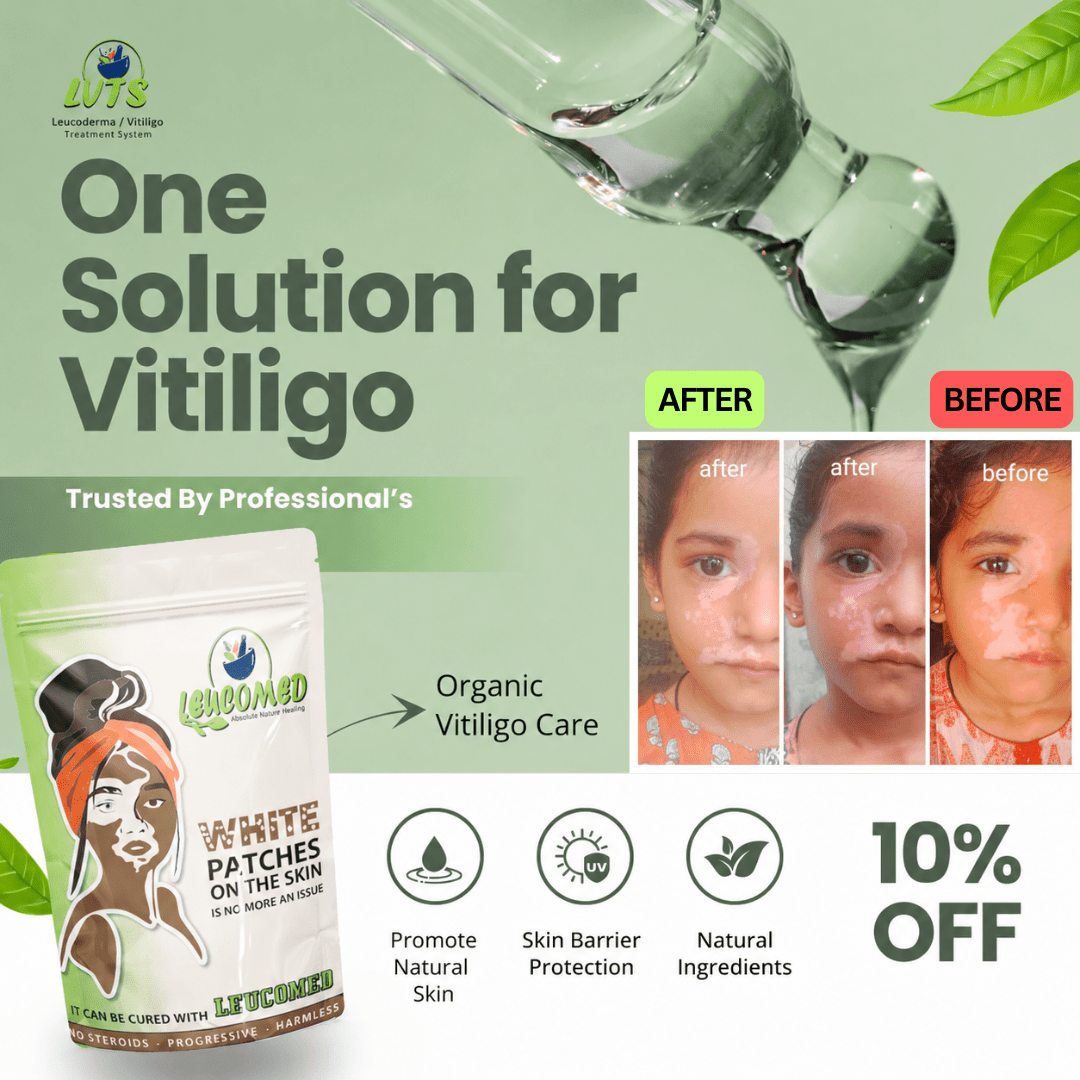 Leucomed - Absolute Natural Healing (60 Days Oral Dosage) - LVTS Leucoderma/Vitiligo Treatment System