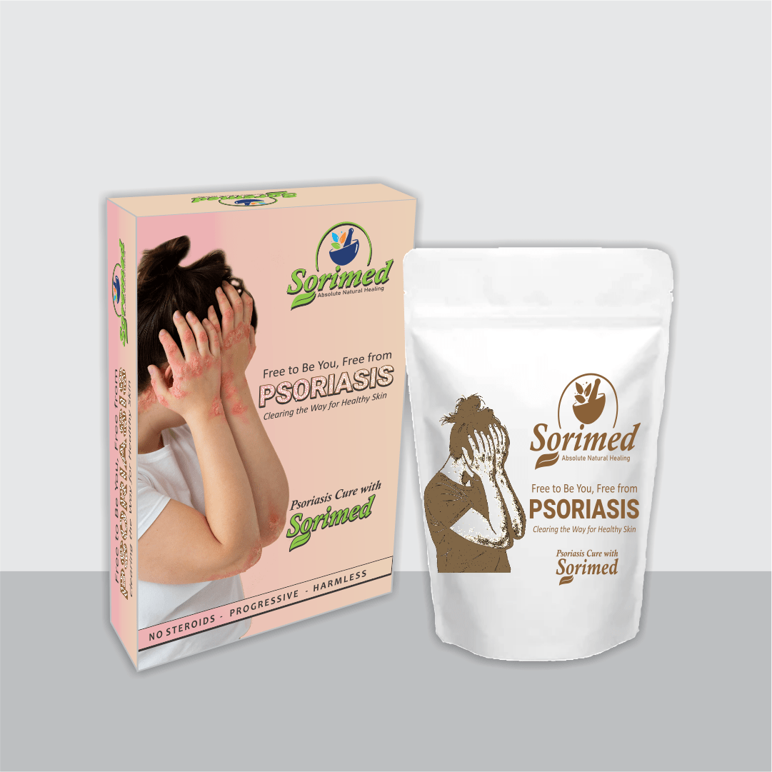Sorimed – Absolute Natural Healing (30 Days Oral Support) - LVTS Leucoderma/Vitiligo Treatment System