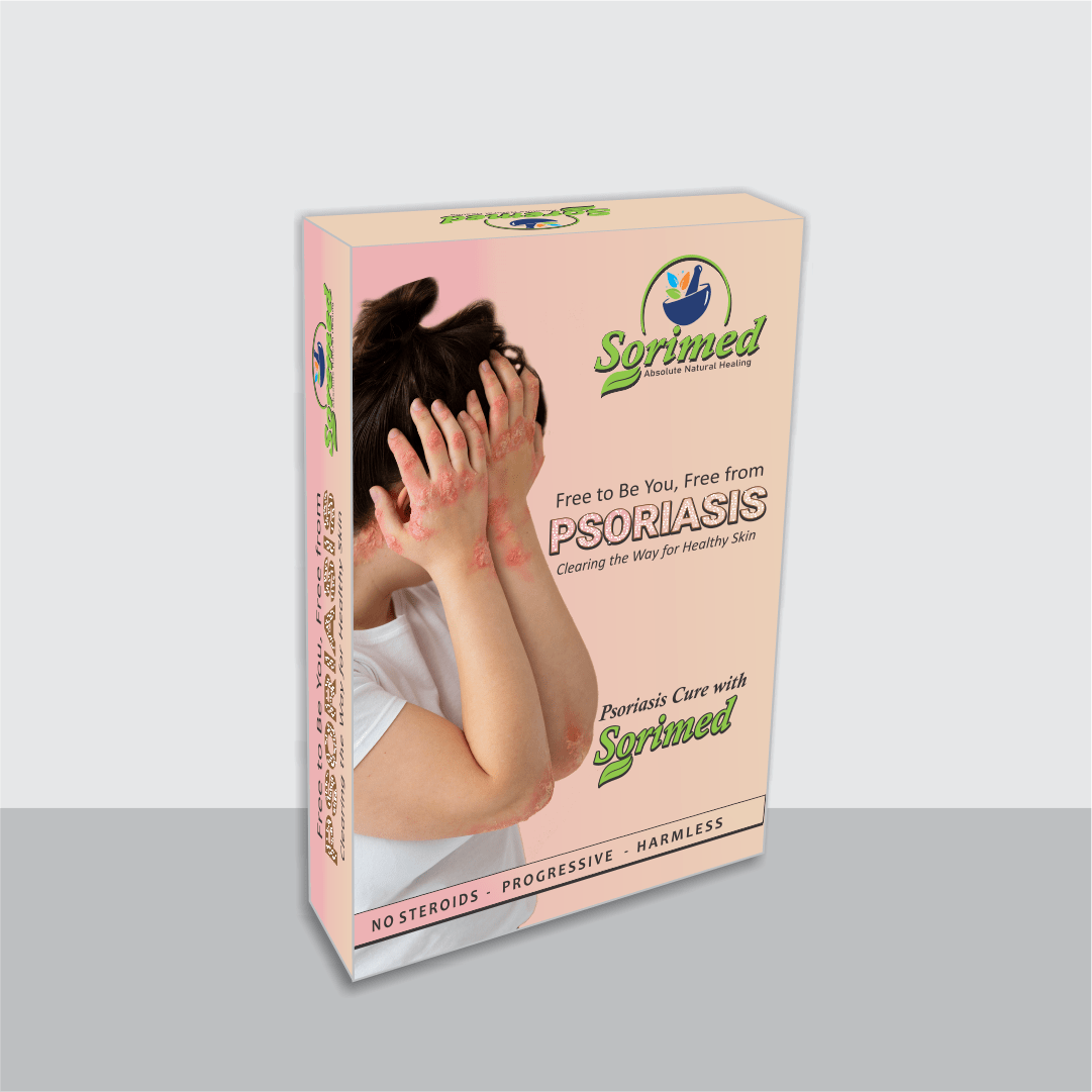 Sorimed – Absolute Natural Healing (30 Days Oral Support) - LVTS Leucoderma/Vitiligo Treatment System
