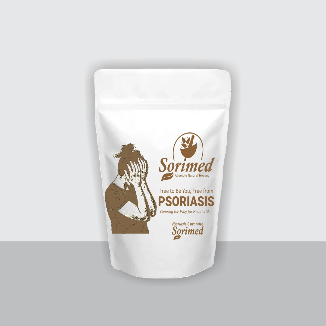 Sorimed – Absolute Natural Healing (30 Days Oral Support) - LVTS Leucoderma/Vitiligo Treatment System