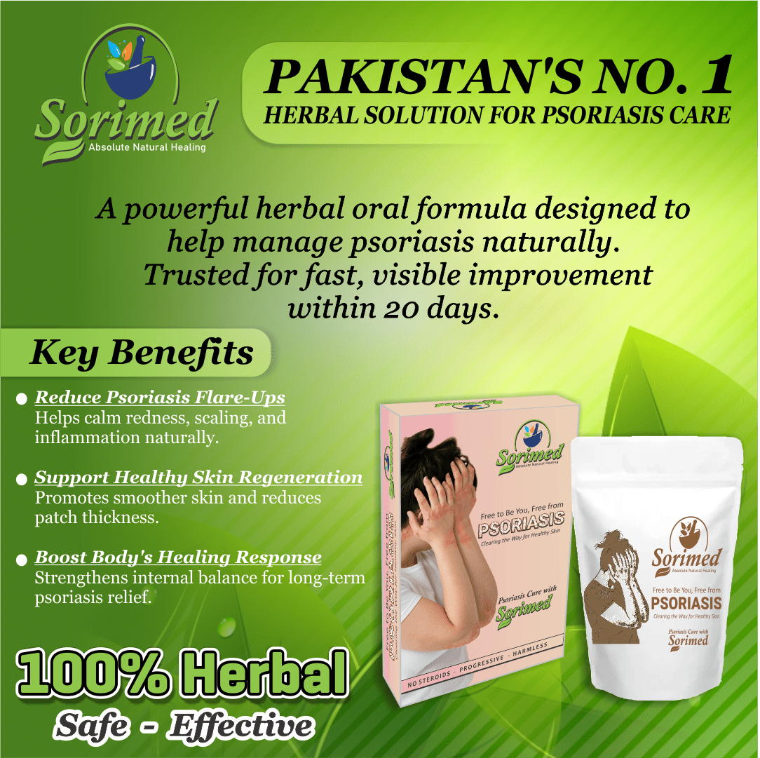 Sorimed – Absolute Natural Healing (30 Days Oral Support) - LVTS Leucoderma/Vitiligo Treatment System